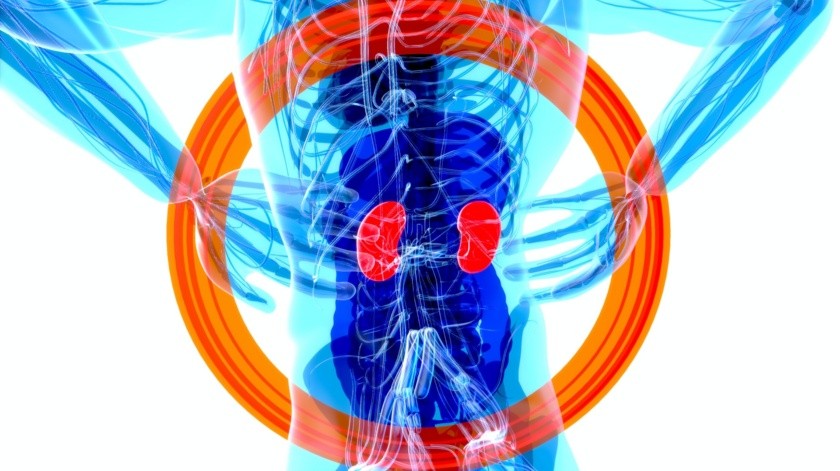 El cáncer renal es originado en el riñón(UNPLASH)