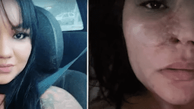 Mujer buscaba operarse la nariz y terminó con el rostro desfigurado