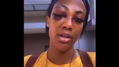 VIDEO: Atleta casi pierde un ojo tras ser atacada por un vagabundo en la calle