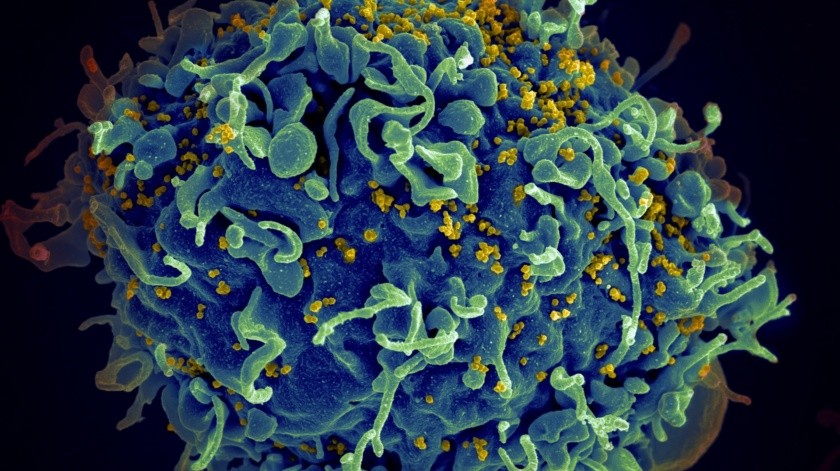La paciente de Barcelona ha pasado 15 años controlando el VIH sin tratamiento.(Archivo)