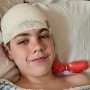 Adolescente con tumor cerebral es diagnosticado erróneamente con Covid-19 prolongado