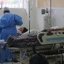 Bolivia asciende a 14 casos confirmados de viruela del mono