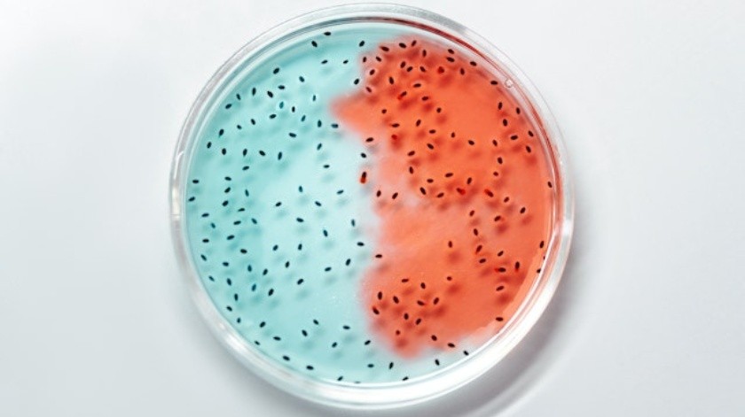 Autoridades de Baltimore investigan la bacteria E.coli(Pexels.)