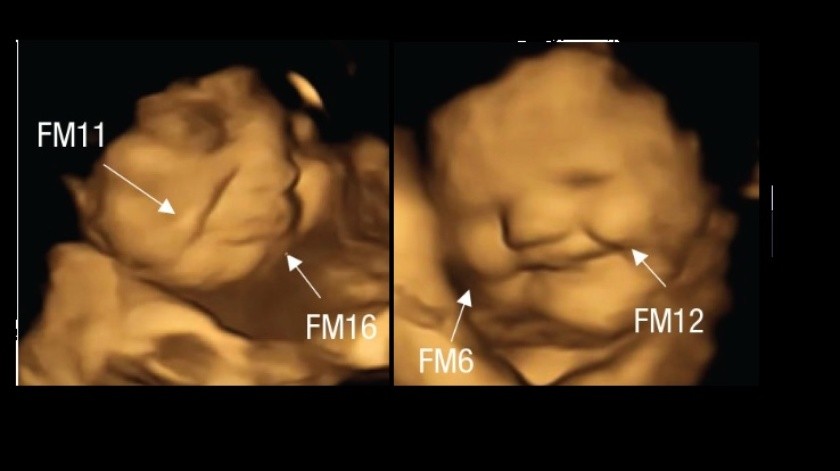 Así se mostraron las expresiones de los fetos.(Capture.)
