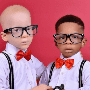 Hermanos mellizos con distinto color de piel; una condición genética provocaría su diferencia de tez