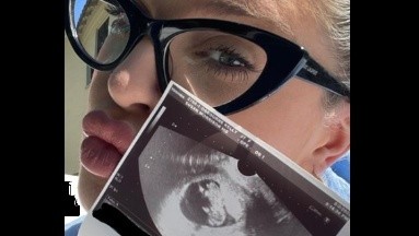 Diabetes gestacional: Kelly Osbourne la desarrolló en el tercer trimestre de embarazo