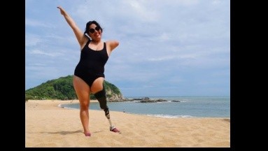 Mexicana que nació sin un brazo y pierna crea conciencia: 