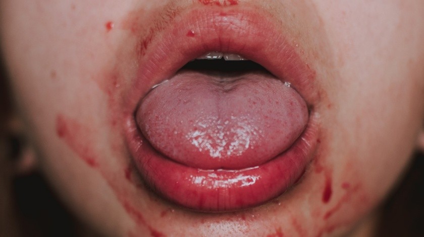 El cáncer que afecta el interior de la boca(UNSPLASH)