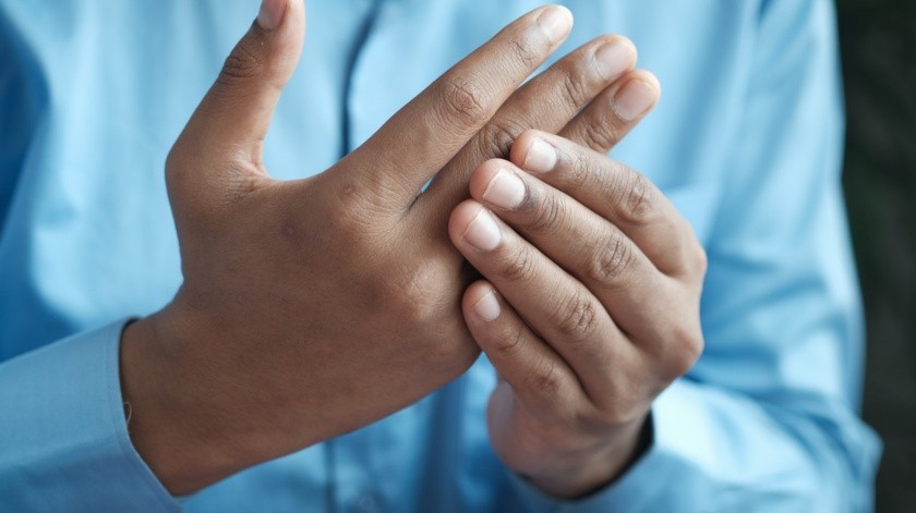 Forma de artritis que causa dolor e inflamación(UNSPLASH)