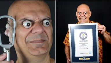 Un hombre tiene el récord de los ojos más saltones del mundo: 