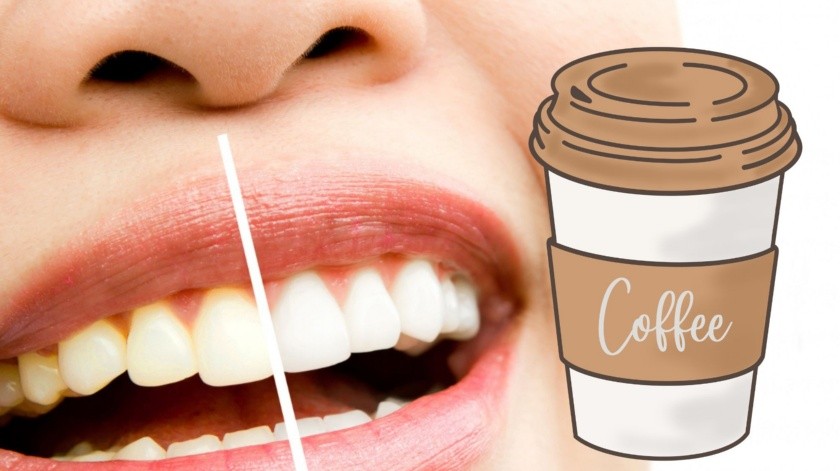 El café puede ocasionar manchas en los dientes.(Freepik-Canva)