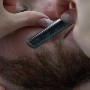 Los hombres que se afeitan la cara pueden desarrollar pseudofoliculitis, ¿qué es?