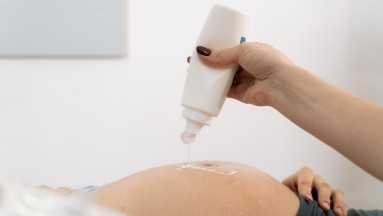 Sobre el embarazo, estudio revela altas tasas de deficiencia de hierro en el último trimestre