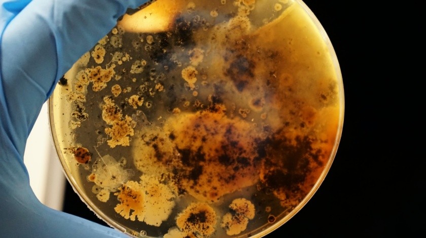 Mycobacterium leprae.(UNSPLASH)