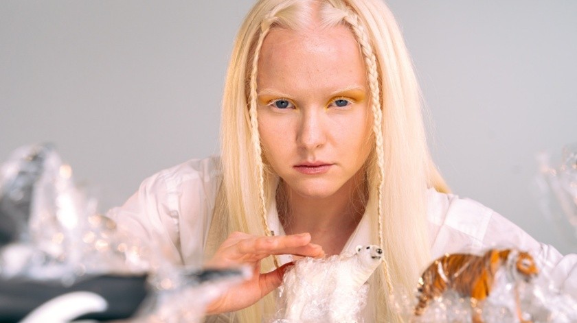 Consecuencias del albinismo(PEXELS)