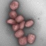 Estudio sugiere que virus de la viruela del mono podría transmitirse también por vía aérea