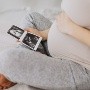 El Reino Unido permitirá el aborto de fetos con Síndrome de Down