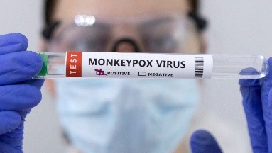 Argentina confirma su primer fallecido por viruela del mono “mpox”