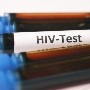 VIH: Candidata a vacuna induce respuesta inmunitaria en ensayo clínico