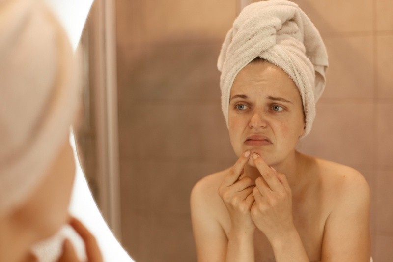El acné puede afectar el autoestima de la persona. Archivo GH. 