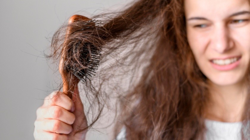 El estrés puede provocar la caída del cabello y otros síntomas.(Freepik)