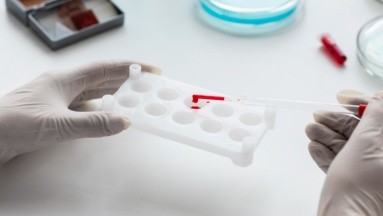 Una muestra de sangre puede detectar un biomarcador del Alzheimer: Estudio
