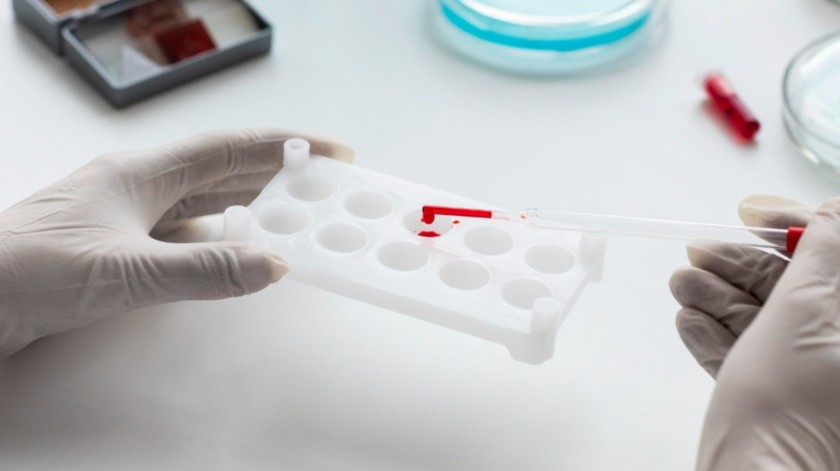 Un análisis de sangre permitiría detectar un biomarcador del Alzheimer.(Freepik)