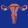 Fibromas uterinos, ¿qué se puede hacer?