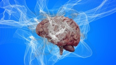 Para el Alzheimer, FDA aprueba nuevo fármaco para retrasar deterioro cognitivo