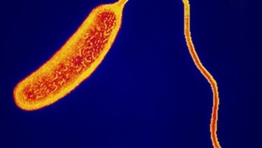 Cólera: En tres meses la enfermedad le arrebató la vida a 457 personas en solo 3 meses