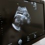 El Covid-19 podría afectar el cerebro del feto durante el embarazo, según estudio