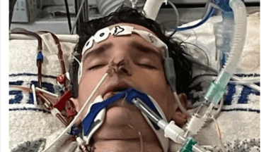 Joven pasó 10 días en coma tras contraer gripe que se convirtió en neumonía
