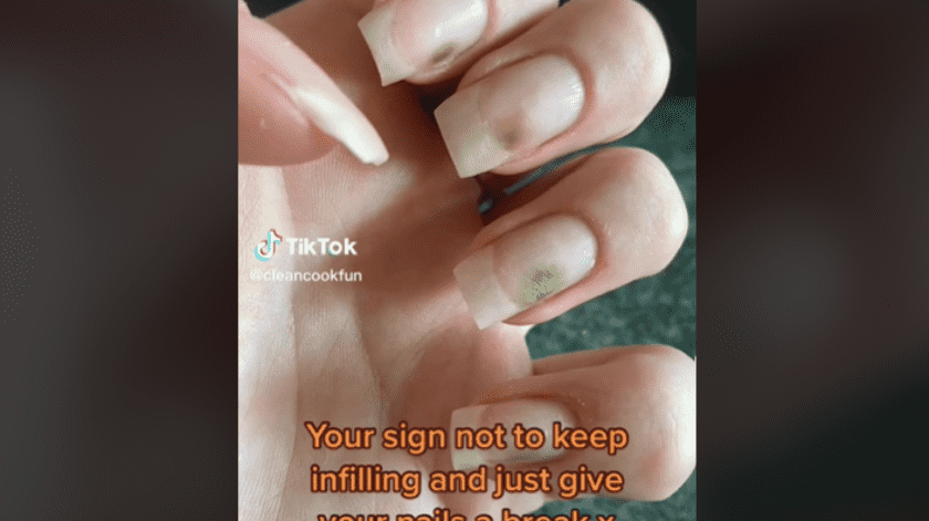 La joven compartió que le salió moho en sus uñas.(Captura)