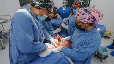 En el IMSS le extraen a mujer un tumor del tamaño de un balón de fútbol