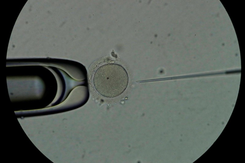  Los investigadores encontraron que el esperma congelado tiene los mismos resultados in vitro que el semen fresco. Foto: EFE