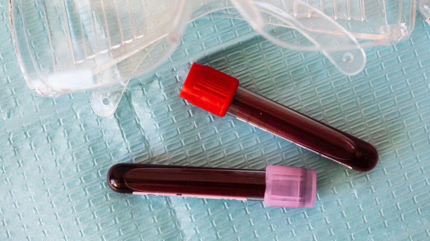 La anemia aplásica también puede dar fiebre aparte de fatiga en general.(Pexels.)