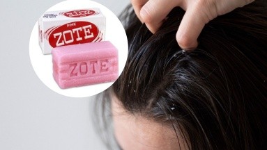 ¿Es recomendable usar el jabón Zote para combatir la caspa? Dermatóloga aclara el mito