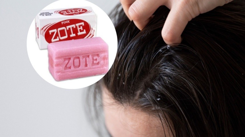El jabón Zote se ha utilizado de diferentes maneras desde su creación en 1970.(Internet-Canva)
