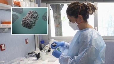 Tras un deceso progresivo de mpox, Perú continuará con la vigilancia epidemiológica a nivel nacional