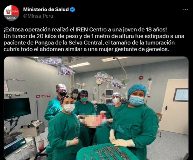 A una paciente de 18 años le extirparon un tumor de 20 kilos en Perú. Foto: Minsa