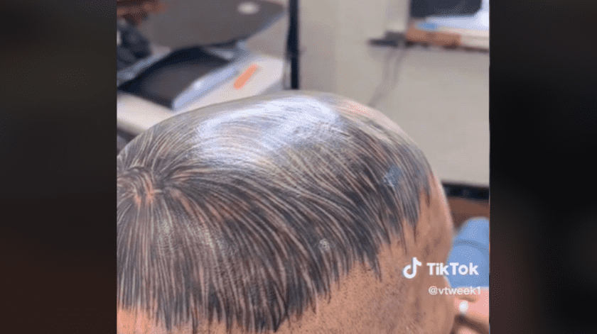 El hombre se tatuó un peluquín para simular cabello y su video se viralizó en TikTok(Captura)