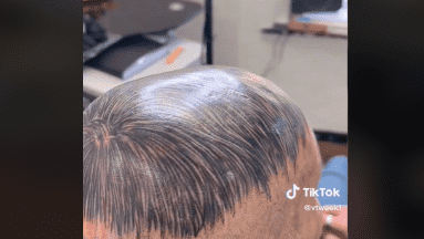 VIDEO: Se tatuó la cabeza para simular cabello, ¿cuáles son los riesgos de los tatuajes?
