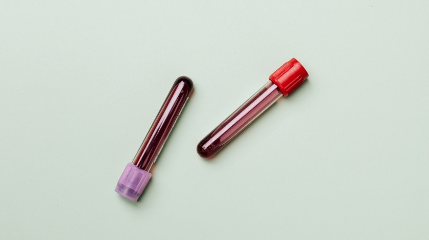 La hemoglobina baja puede ser un síntoma de anemia y otras enfermedades(Pexels.)