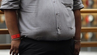 En México sólo el 5 % a 8 % de personas que necesitan tratamiento para obesidad lo reciben