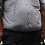 En Méxicp sólo el 5 % a 8 % de personas que necesitan tratamiento para obesidad lo reciben