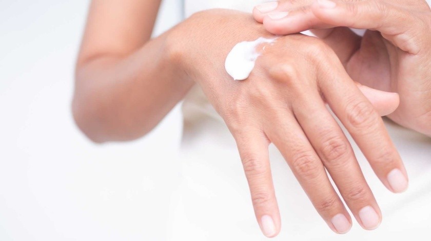 La resequedad en la piel puede ocasionar infecciones.(Archivo GH.)