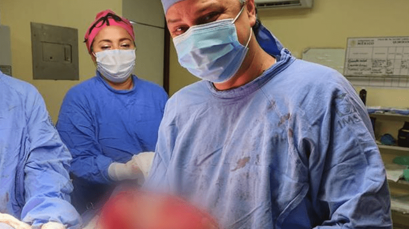 Un paciente fue intervenido en el IMSS de Veracruz para que le extirparan un tumor de aproximadamente 13 kilos.(Cortesía IMSS)
