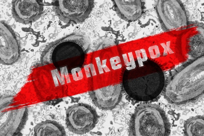 Portugal registró un nuevo brote de mpox. Foto: Archivo