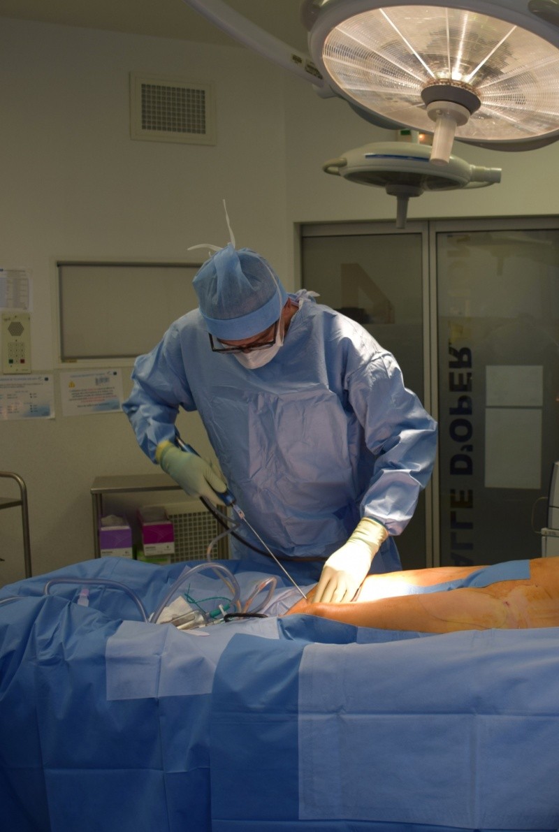 La liposucción es una extracción del exceso de grasa corporal por medio de succión usando un equipo quirúrgico especial. FOTO:philippe spitalier/UNSPLASH