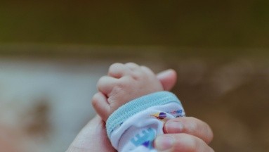 El caso de polimelia en India: Un bebé nace con un tercer brazo